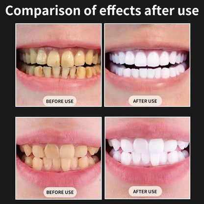 Kit de blanqueamiento Dental recargable para dientes, Gel de 4 piezas, acelerador de lámpara Led